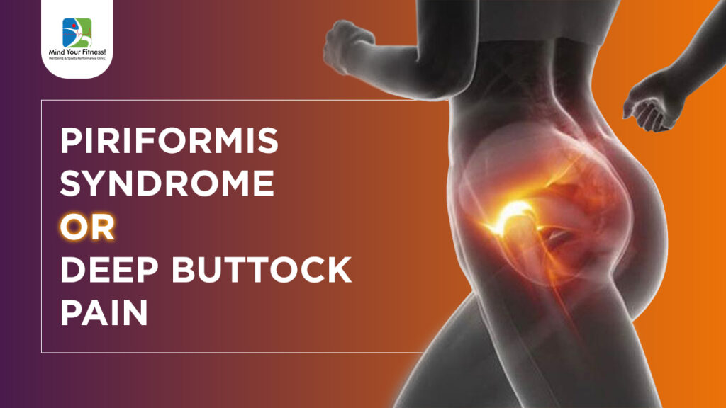 Piriformis syndrome.. has anyone dealt with this? Realizing this