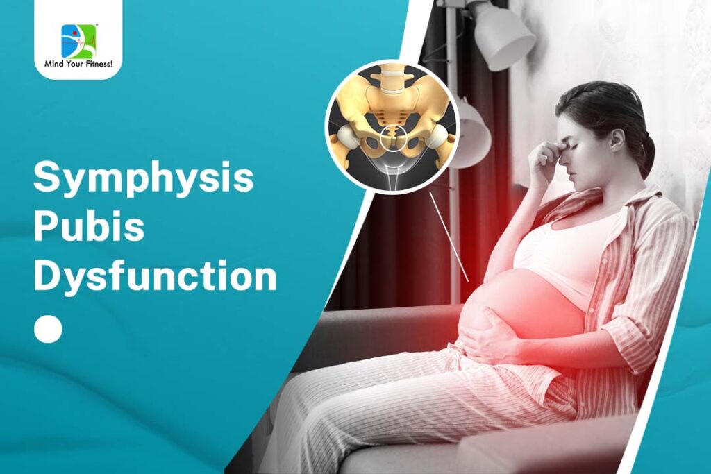 Symphysis Pubis Dysfunction
